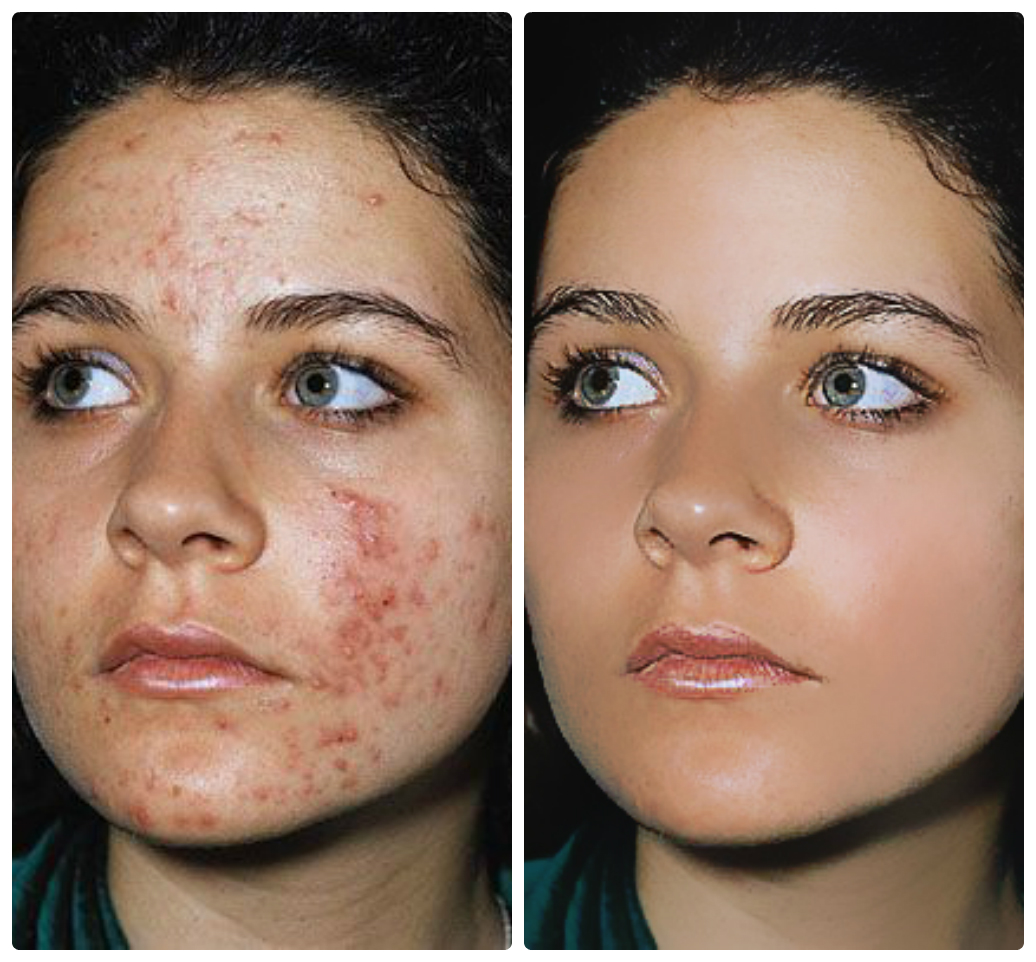 ретушь фотографий